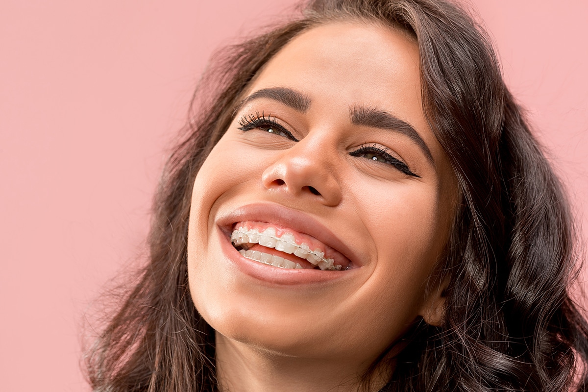 How Much Do Braces Cost?