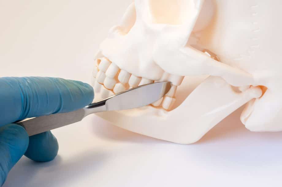 Is Orthognathic Surgery Dangerous? | Demko Orthodontics